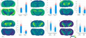 six pairs of brain images, each with a different pattern of blue, green, and yellow. Beside each pair, a bar chart with two bars showing the quantified intensity difference between samples treated with HIV drug Efavirenz and untreated samples.